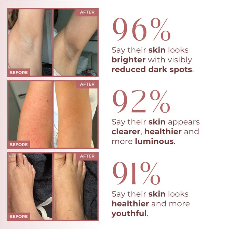 PEEL SHOT 99% Kojic Acid + Turmeric Body Exfoliating Spray