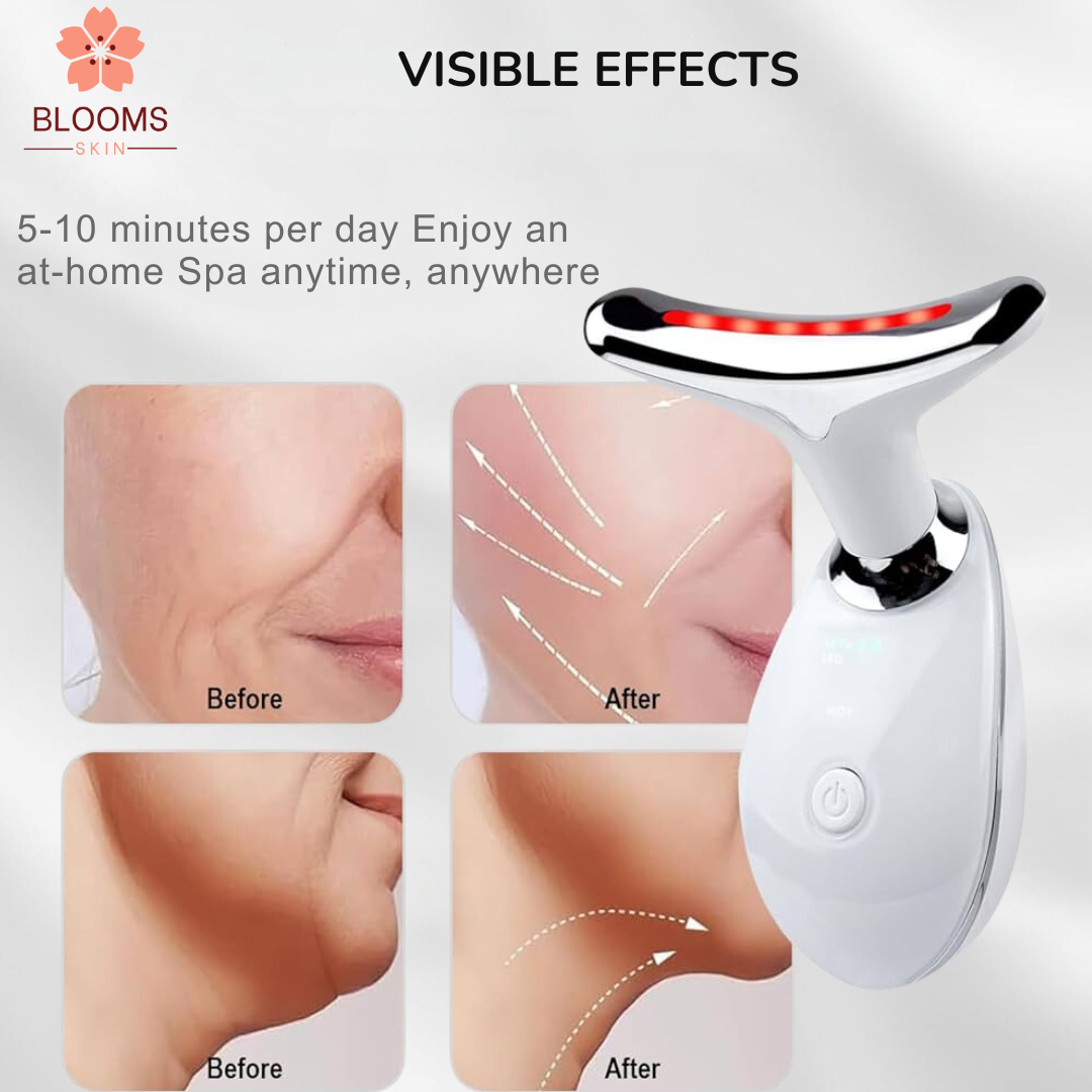 EMS Thermal Neck Lifting And Tighten Massager Electric Microcurrent Wrinkle Remover