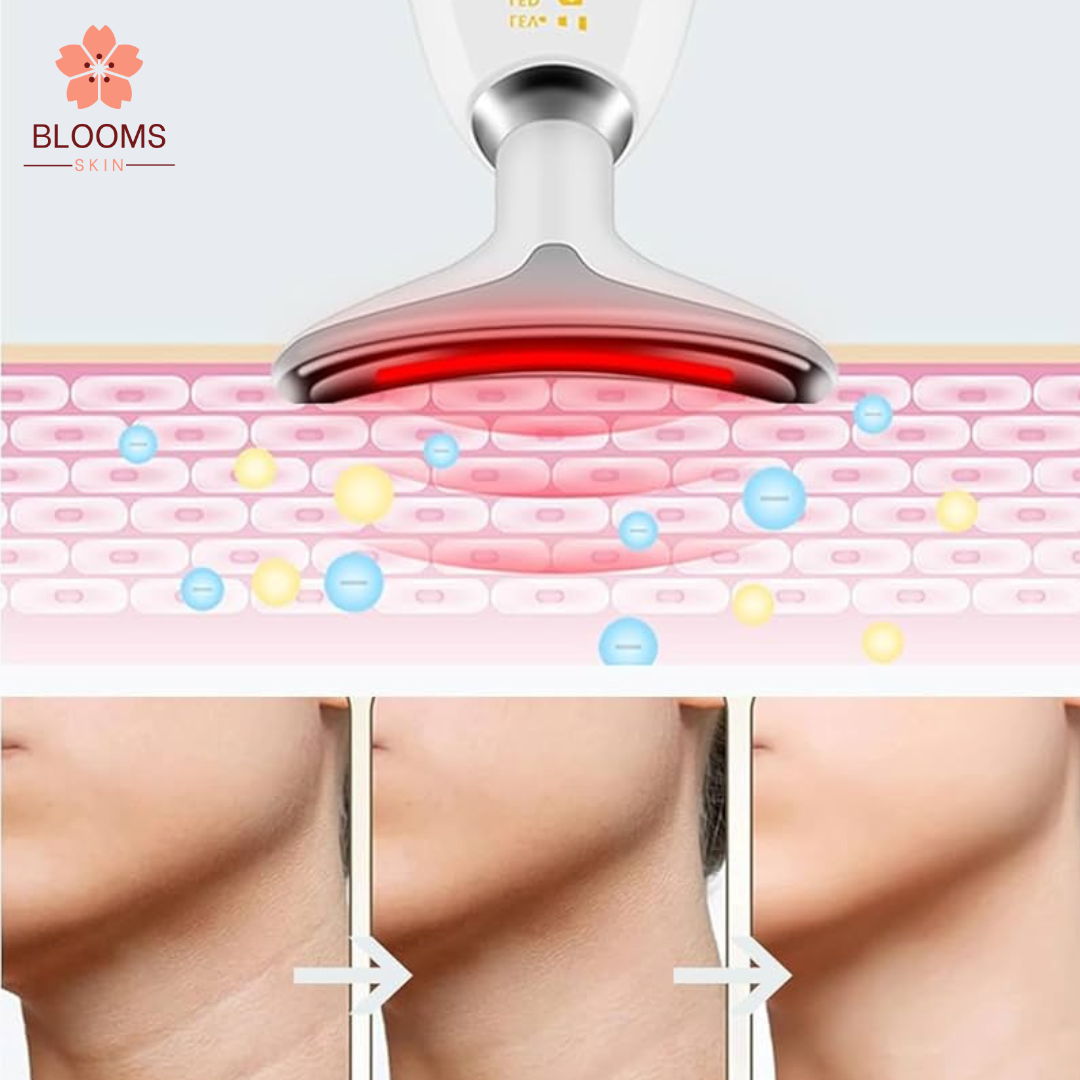 EMS Thermal Neck Lifting And Tighten Massager Electric Microcurrent Wrinkle Remover