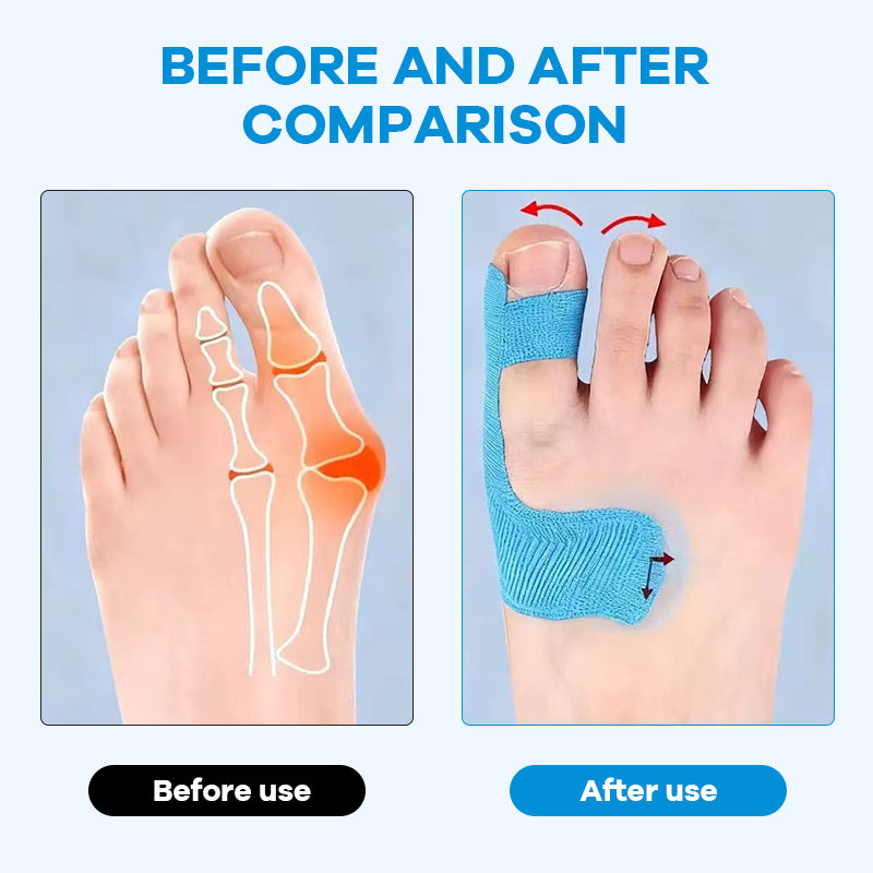 Pre-cut Bunion Corrector Kinesiology Tape