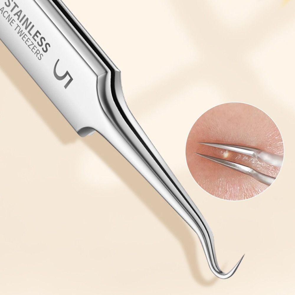 Professional Blackhead & Acne Extractor Kit