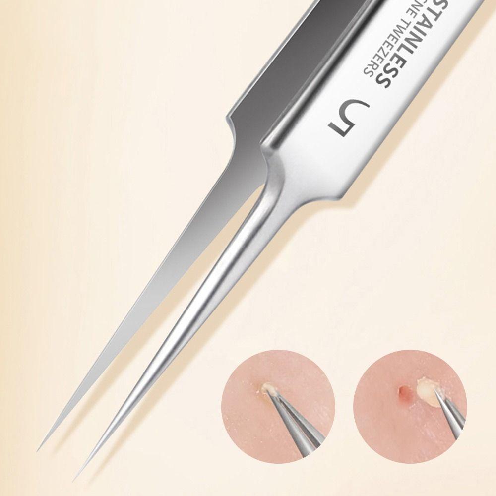 Professional Blackhead & Acne Extractor Kit