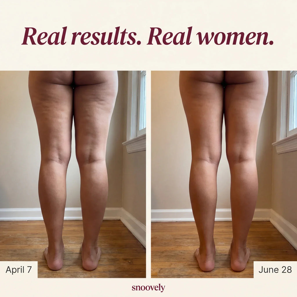 🍑Snoovely 3D Anti-Cellulite Leggings – Sculpt, Smooth & Shape with Every Step